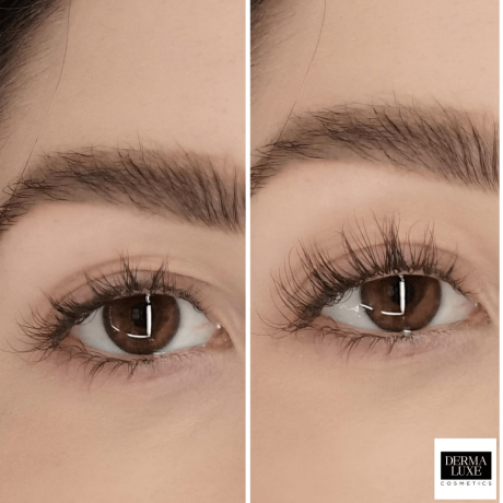DERMALUXLASH - SERUM ZA RAST TREPALNIC